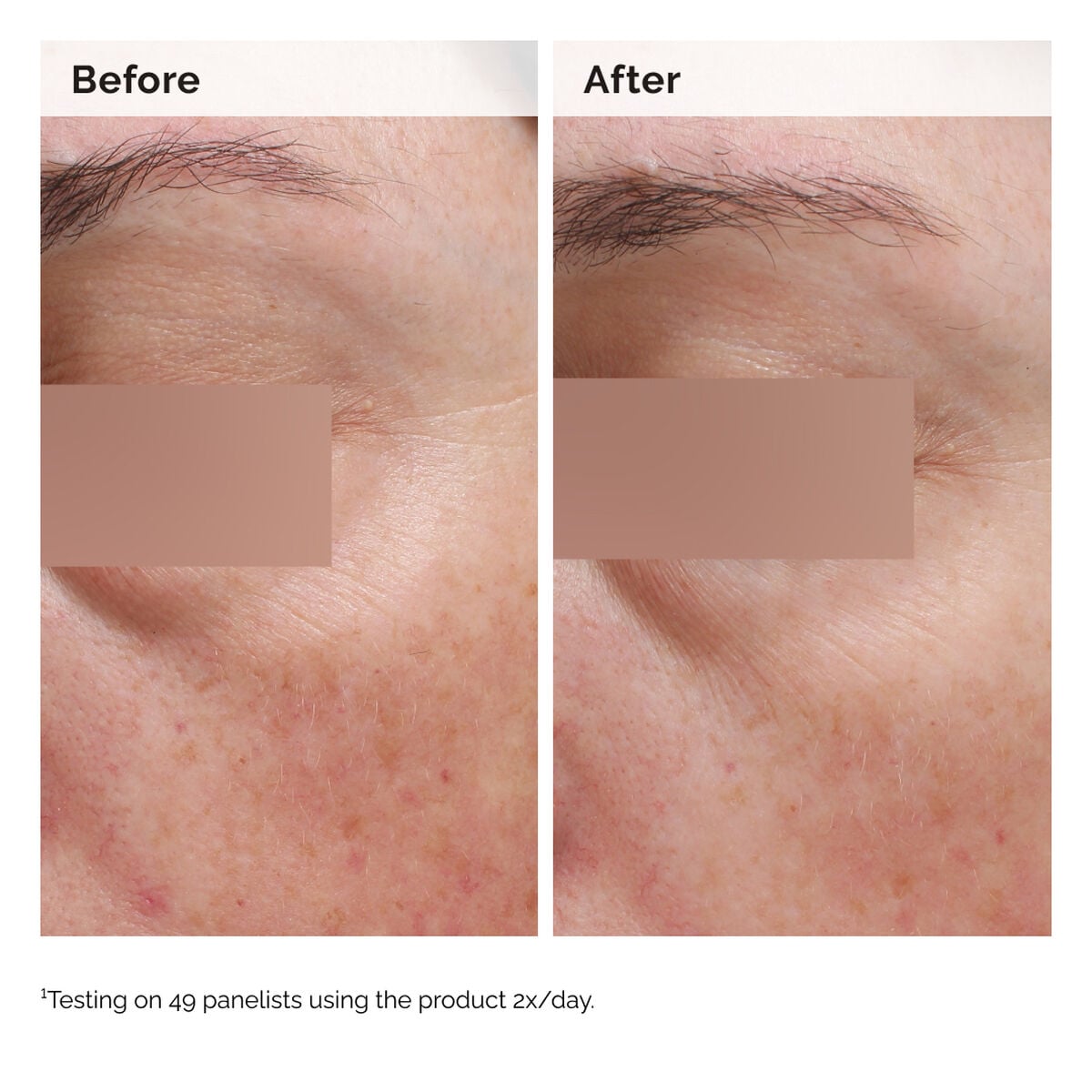 niacinamide-5-face-and-body-emulsion-w3 2024-08-23-ORD-Nia-5pct-Face-Body-B-A-Elasticity-Global-02-1x1.jpg