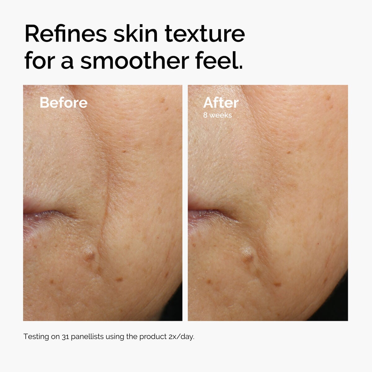 caffeine-3-escin-1-face-serum-e9 ord-caffeine-3pct-escin-1pct-face-serum-before-after-texture.jpg