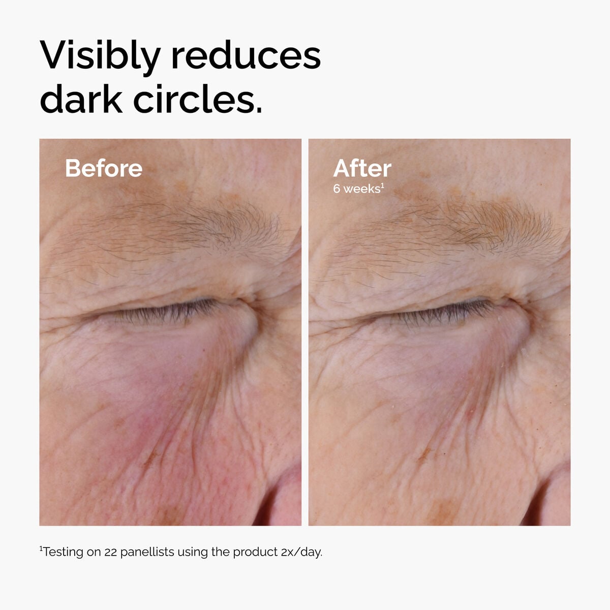 caffeine-solution-5-egcg-eye-serum-t5 ord-caffeine-solution-egcg-dark-circles-before-after.jpg