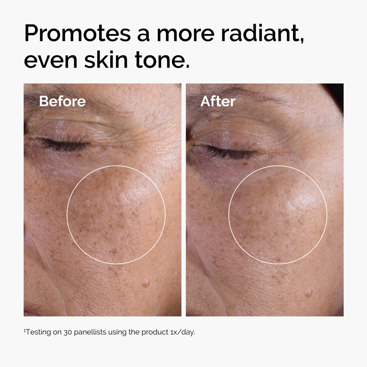 glycolic-acid-7-exfoliating-toner-v8 ord-glycolic-before-after-radiance.jpg
