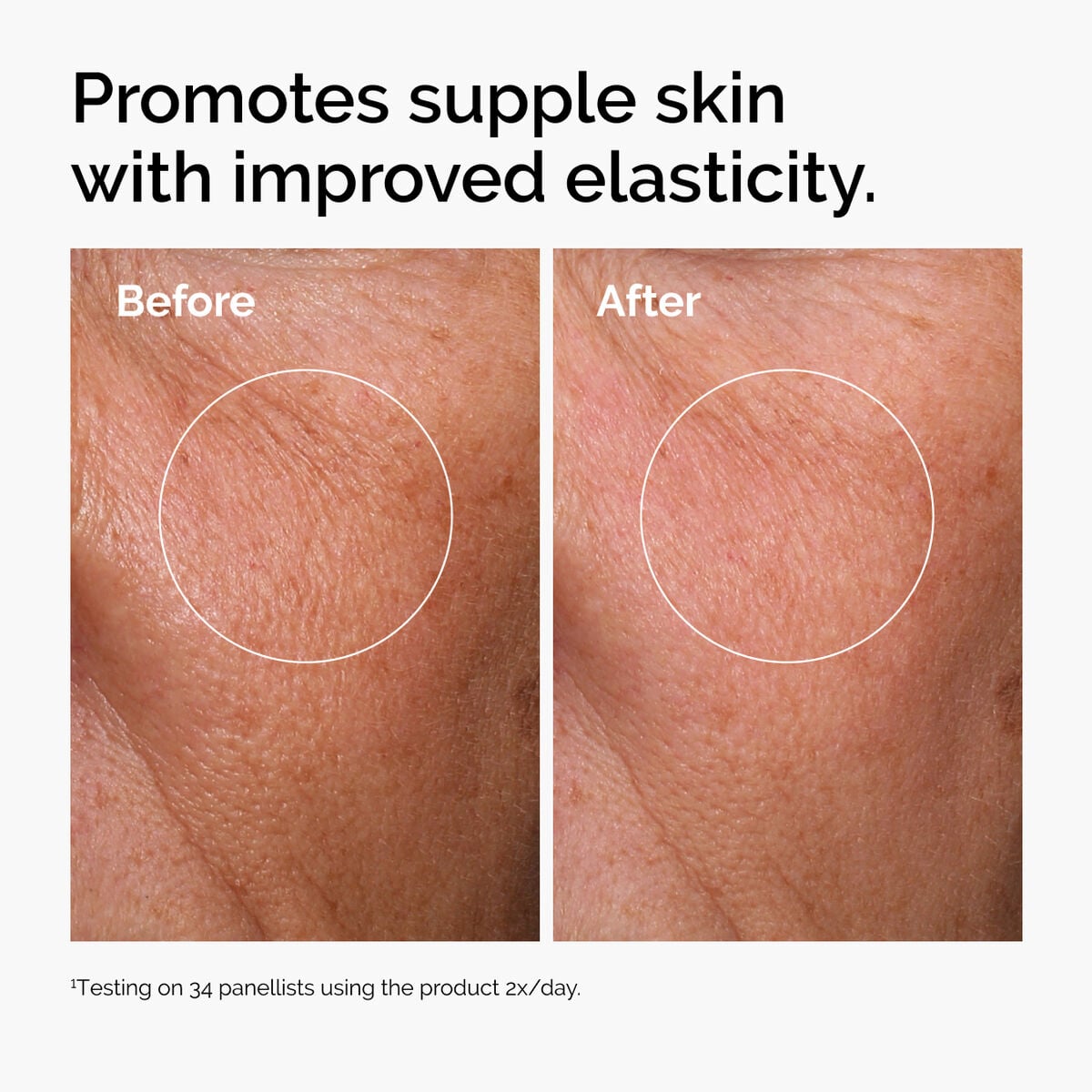 hyaluronic-acid-2-b5-with-ceramides-a9 ord-hyaluronic-acid-2pct-b5-hydrating-serum-before-after-elasticity.jpg