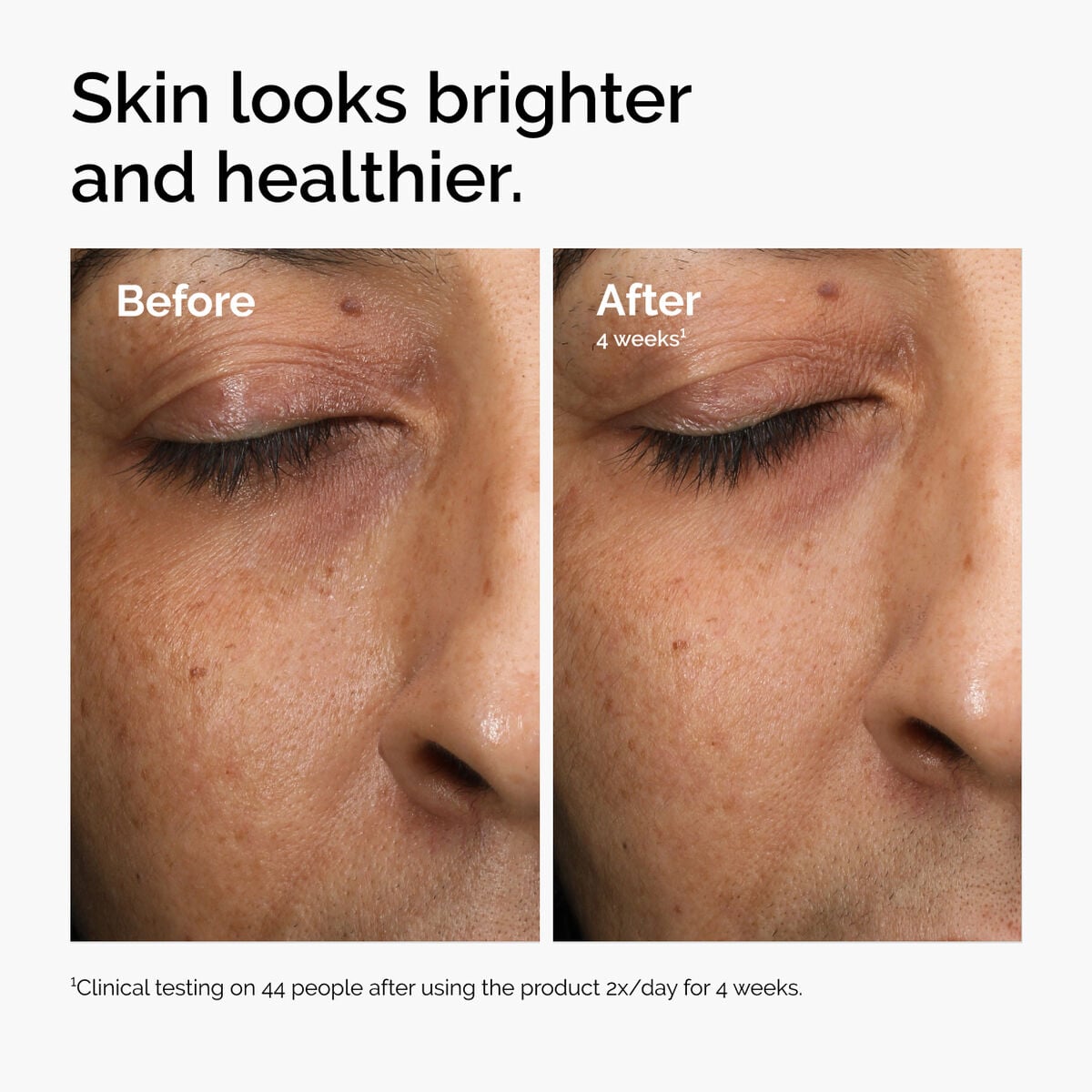 multi-antioxidant-radiance-serum-d6 ord-mars-before-after-healthy.jpg