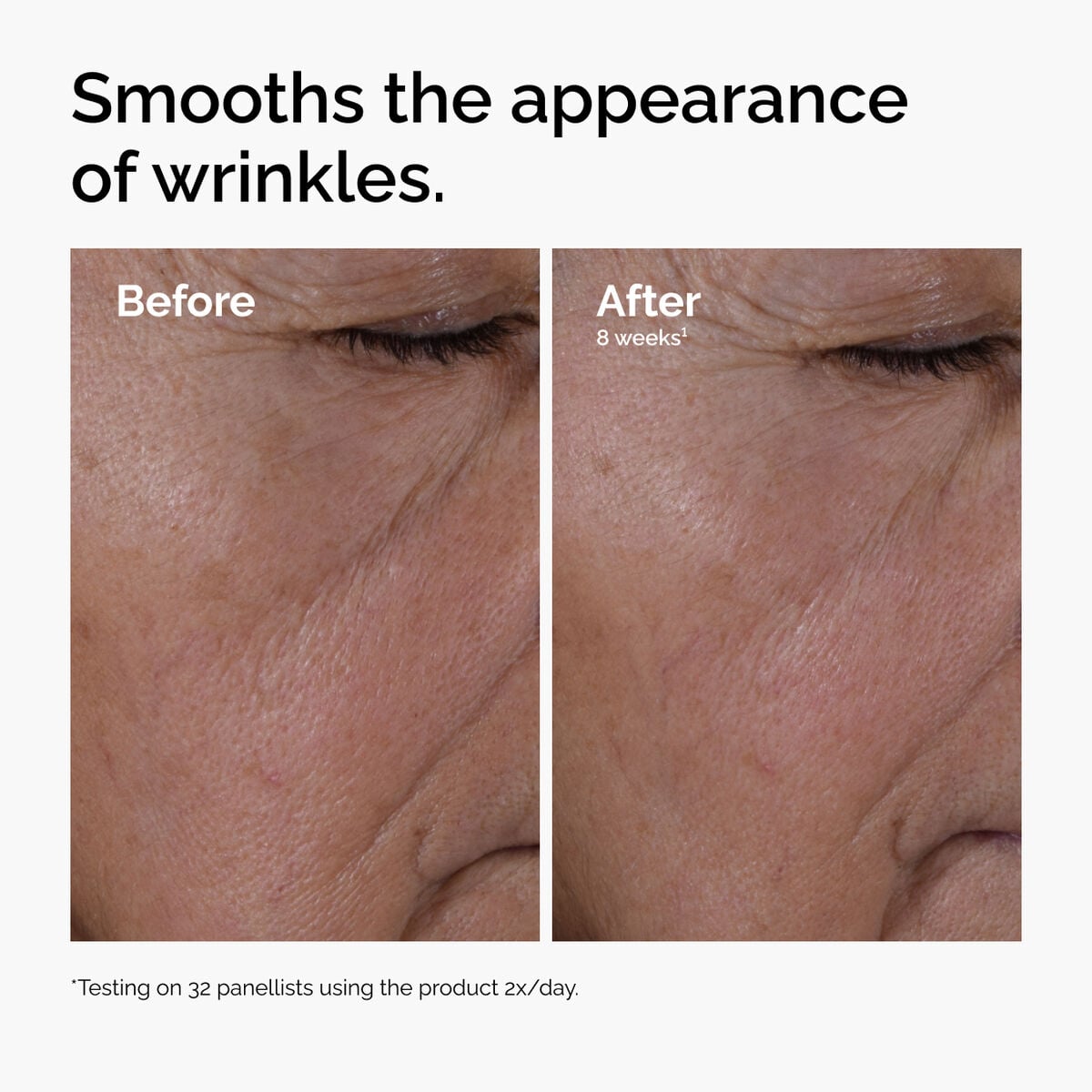 multi-peptide-ha-serum-e6 ord-multi-peptide-ha-serum-wrinkles-before-after.jpg