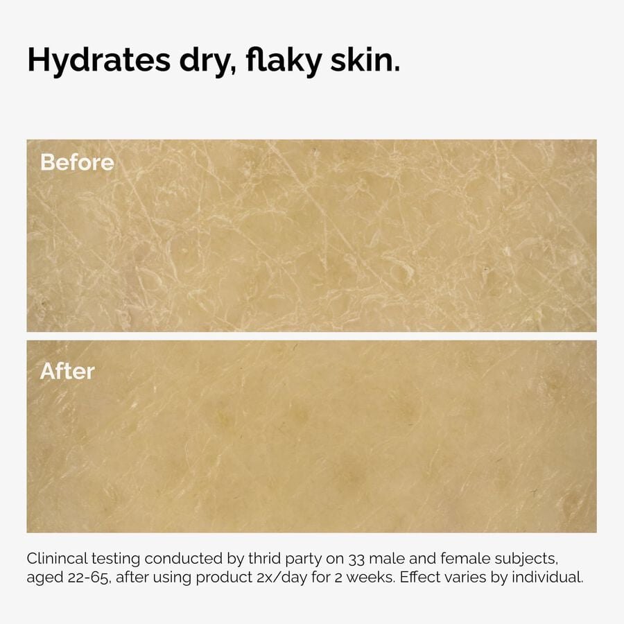 the-body-care-collection-w3 ord-natural-moisturizing-factors-inulin-body-before-after-graphic-02.jpg