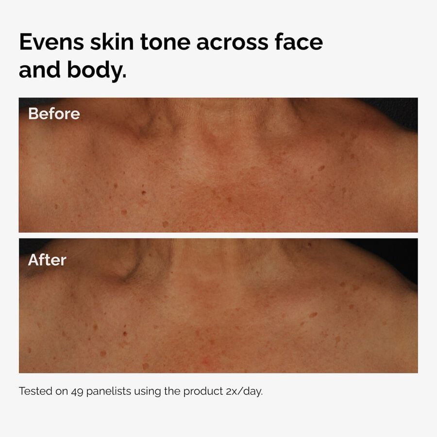 the-body-care-collection-w3 ord-niacinamide-face-body-serum-before-after-even-tone-graphic.jpg