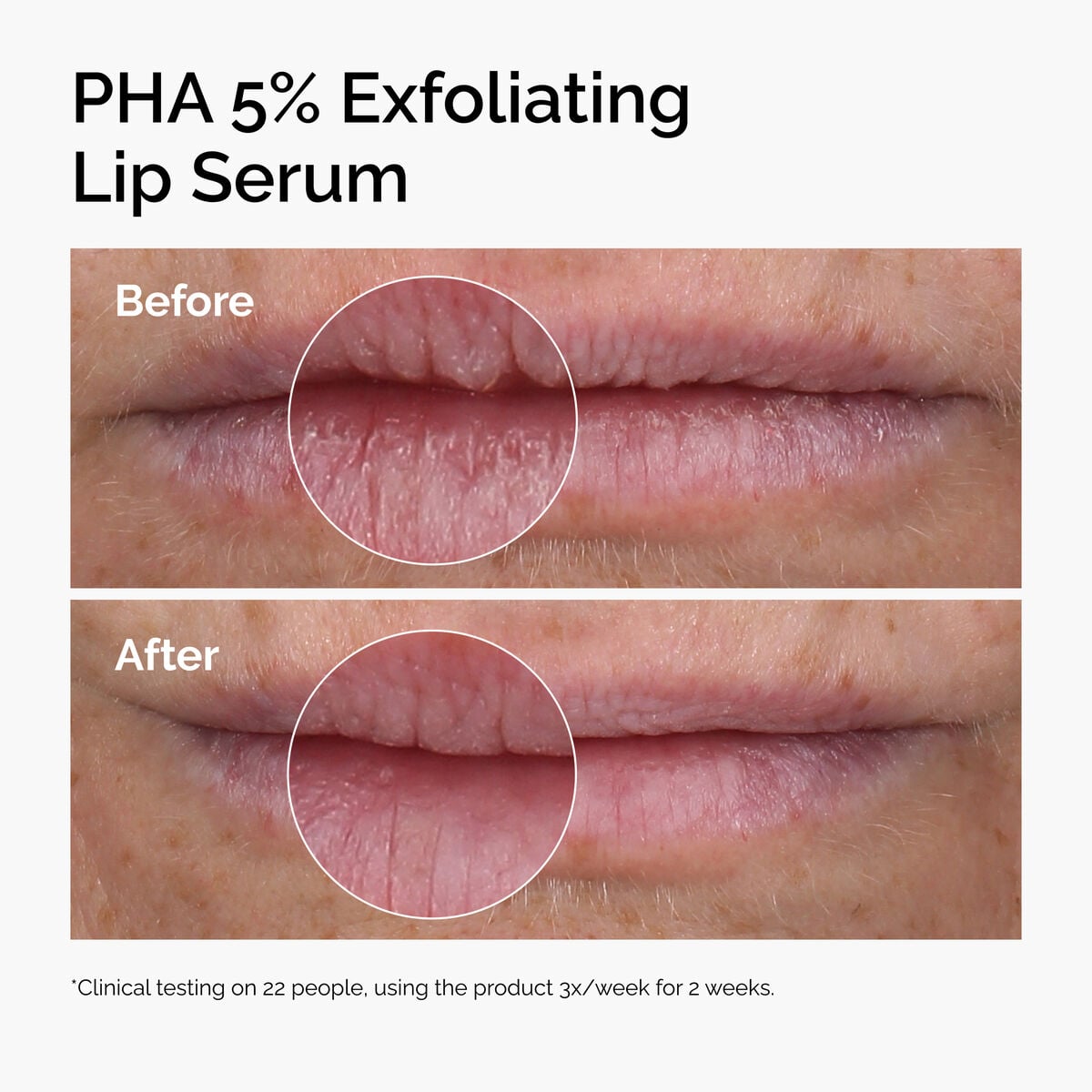 pha-5-exfoliating-lip-serum-j2 ord-pha-5pct-lip-exfoliating-serum-before-after.jpg